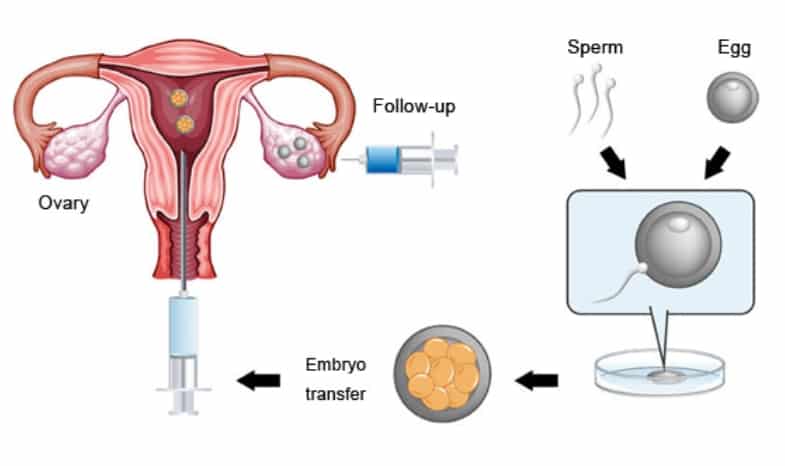 what is embryo transfer